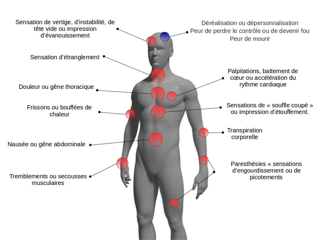 Qu’estce Qu’une Attaque De Panique Et Comment La Surmonter